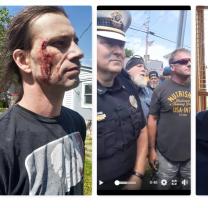 A guy with a bleeding face, cops and protestors